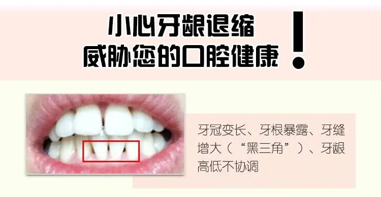 什么是牙龈萎缩?
